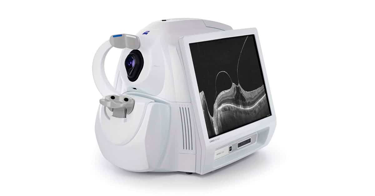 Exame de Tomografia de Coerência Óptica - OCT | NeoOftalmo