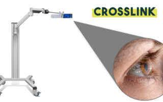 Conheça o CrossLink, nova tecnologia da Neo Oftalmo!