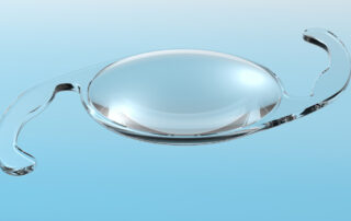 As diversas opções de lente intraocular para a cirurgia de catarata