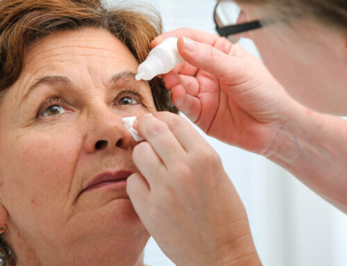 A Síndrome do Olho Seco pode comprometer a Cirurgia de Catarata?