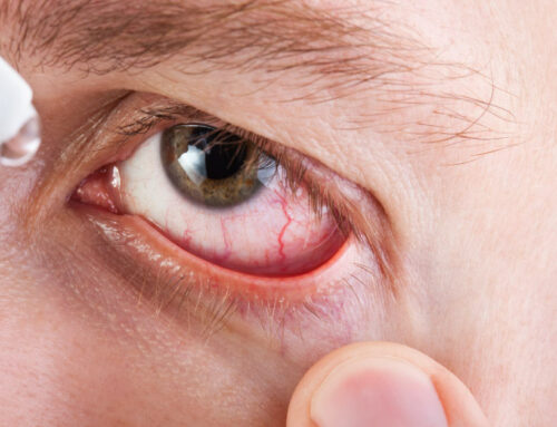 O glaucoma pode causar cegueira irreversível!
