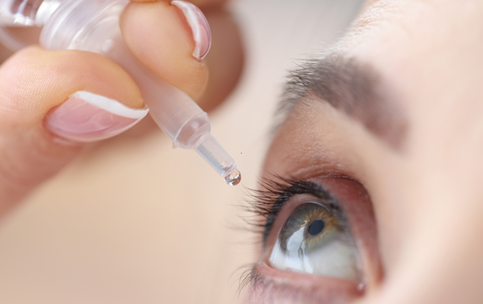 Paciente aplicando colírio antibiótico após cirurgia ocular
