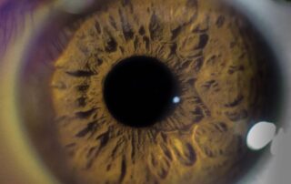 Foco no olho para exame de oftalmologia