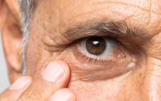 vabysmo para tratamento de DMRI